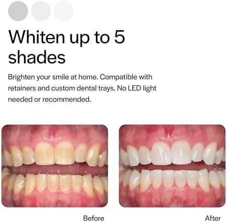 Opalescence 10% Teeth Whitening Kit - Gel Syringes Refills - Low Sensivity (2 Packs / 4 Units) - Fluoride, Carbamide Peroxide - Made in The USA by Ultradent 5211-2