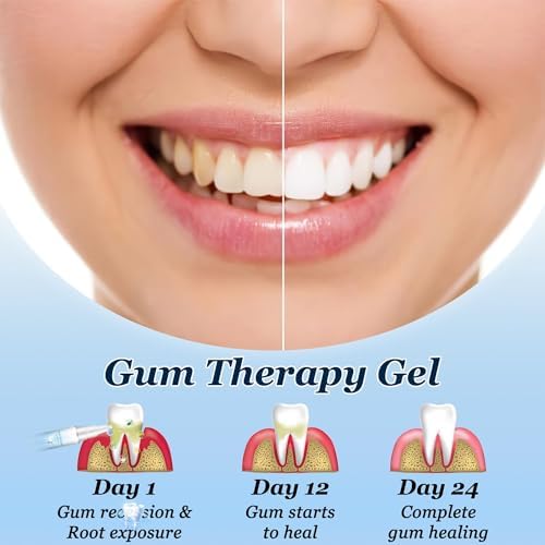 Omaky Gum Protect Repair Gels,Gum Shield Gel, Gum Gel Teeth Whitening Essence Pen, Gum Instant Protect Gel, Instant Tooth Whitening Pen Sensitive Teeth (3PC) (A)