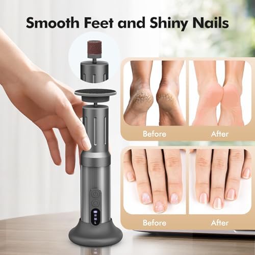Electric Foot Callus Remover Cordless Electric Foot Filer Kit with 6Speeds Chagring Dock Callus Remover for Women Men Feet and Nail(Black)