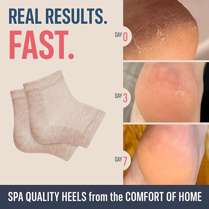 Dr. Frederick's Original Moisturizing Heel Socks for Cracked Heel Treatment - 2 Pairs - Socks for Dry Feet - Cracked Skin Repair & Overnight Hydration - Foot Care for Women & Men - Shea Butter